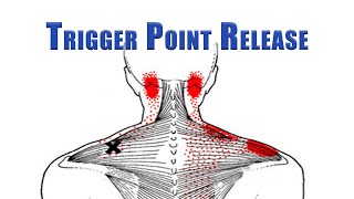 Trigger Point Release  Upper Trapezius Levator Scapulae and Suboccipitals  No Tools Needed [upl. by Noid]