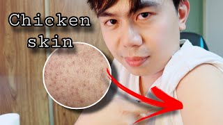 Proven EFFECTIVE to minimize CHICKEN SKIN  Nurse tips [upl. by Aihset]