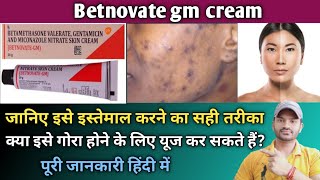 Betnovate gm cream use dose benefits and side effects full review in hindi [upl. by Eidassac267]