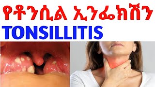 Tonsillitisየቶንሲል ኢንፌክሽን Tonsillitis treatment pharmacy doctor pharmacology antibiotics [upl. by Intruoc]