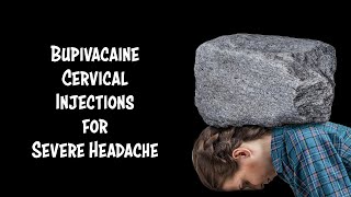 Cervical Injections for Headache in Honduras [upl. by Jacobo]