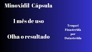 Minoxidil antes e depois 1 mês  minoxidil 2mg e Dutasterida 05 da marca Avodart  biotina [upl. by Nigen]