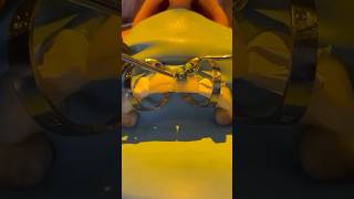 The cementation process for two porcelain veneers veneers veneers cosmeticdentistry [upl. by Anitahs]