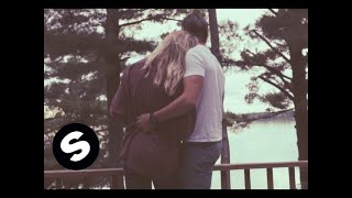 EDX  Breathin Official Music Video [upl. by Eiznekcam252]