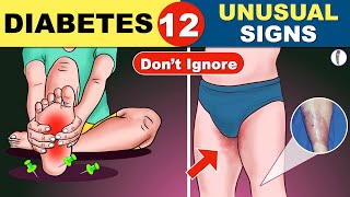 12 Unusual Symptoms of Diabetes  Diabetes Symptoms  Diabetes Mellitus   Diabetes Warning Signs [upl. by Perreault]