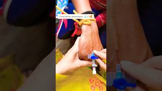 Iv cannulation procedure 🧑‍⚕️😷 shorts cannula trending youtubeshorts mbbs doctor love song [upl. by Septima]