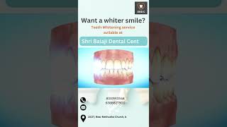 whitening teeth service  SBDC [upl. by Fitton655]