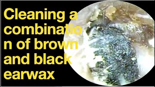 Cleaning a combination of brown and black earwaxear wax removal  ear cleaning  ASMR  relax [upl. by Gustie]