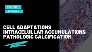 Cell Adaptations Intracellular Accumulations Pathologic CalcificationRobbins Pathology Competency [upl. by Ahsain]