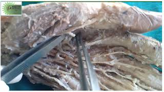 Thenar and Hypothenar Muscles and Lumbricals of Hand  Dr Nishigandha Sadamate [upl. by Fem]