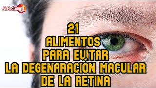 21 Alimentos para evitar la degenaración macular de la retina [upl. by Nagem]