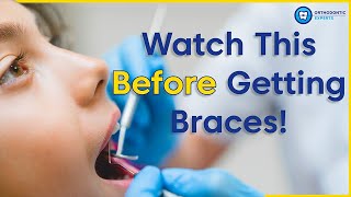 What To Know Before Getting Braces  8 Tips To Prepare You For Braces [upl. by Laiceps858]