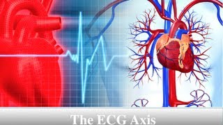 ECG Axis Tutorial Part 3  Determining QRS Axis [upl. by Ewens964]