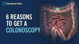 6 Reasons to Get a Colonoscopy [upl. by Fonzie]