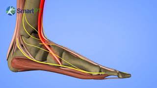 Guide to Peroneal Tendonitis [upl. by Bellamy818]