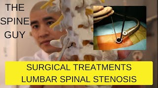 Part 3  Surgical Treatments for Lumbar Spinal Stenosis [upl. by Eisus]