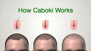 How Caboki Hair Building Fiber Works [upl. by Eenet]