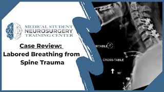 Case Review Labored Breathing from Spine Trauma [upl. by Filemon]