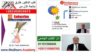 Hypercalcemia cme internalmedicine usmle medicalschool medical محاضراتباطنة [upl. by Edlihtam]