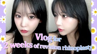 nose job VLOG Revision rhinoplasty  fat grafting at BYUL Korea🥰💜 [upl. by Ellis]