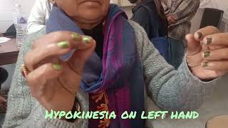 hypokinesia testing in Parkinsons Diseasedoctor sathi [upl. by Ahselrak]