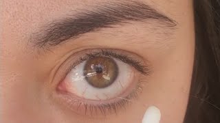 Compilation of eye junk removal Eye fishing syndrome 🎣🎣 [upl. by Hanafee]