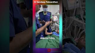 Paediatric Forearm Fractures  Closed Reduction Technique  Apex Volar Injury Dr Sandeep Patwardhan [upl. by Senga]