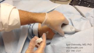 Hyaluronic Acid Injection to the Knee Joint 1 [upl. by Sallad]