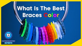 What are the BEST Braces Colors  Braces Color Ideas [upl. by Sada]