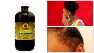 BLACK CASTOR OIL AMAZING RESULTS ALREADY [upl. by Mcgee267]