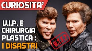 I DISASTRI Celebrità Prima e Dopo la Plastica Estrema [upl. by Spenser]