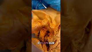 AMAZING Human Heart Valves in Hindi [upl. by Nylevol]