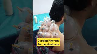 Cupping Therapy Does It Actually Work [upl. by Irat]