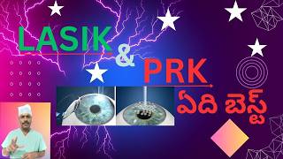 LASIK VS PRK WHAT TO CHOOSE  LASIK VS PRK ఏది బెస్ట్   TELUGU [upl. by Garzon125]