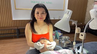 Acne treatment Hương Đà Nẵng đang phát trực tiếp live 2024 [upl. by Osbert]