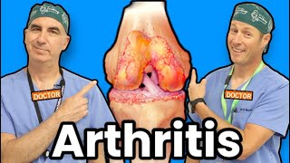 Treating Knee Arthritis Without Surgery [upl. by Boelter]