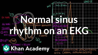 Normal sinus rhythm on an EKG  Circulatory System and Disease  NCLEXRN  Khan Academy [upl. by Attenyt94]