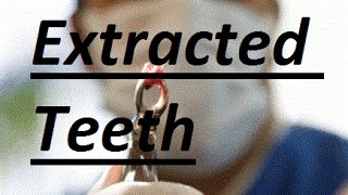 What Can Be Done If Teeth Are Already Extracted by Prof John Mew [upl. by Cordie]