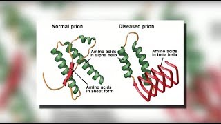 CJD CreutzfeldtJakob Disease  Mayo Clinic [upl. by Fiester]