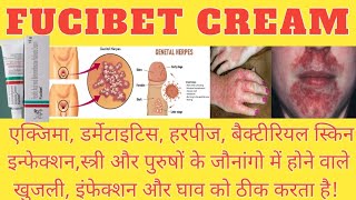 FUCIBET CREAM  हर तरह के स्किन इनफेक्शन और घाव को ठीक करने वाला दावा बैक्टीरियल इनफेक्शन का दावा [upl. by Poppas915]