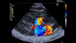 Feline Echocardiography colour Doppler in a cat with SAM [upl. by Doroteya]