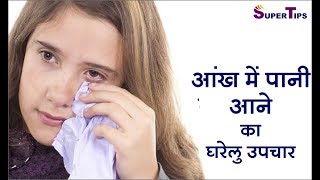 aankh se pani aane ka gharelu upay  watery eyes solution in hindi by super tips [upl. by Anilatac]