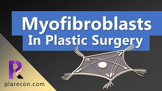 Myofibroblasts in Plastic Surgery [upl. by Htiffirg]