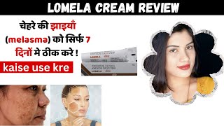 Lomela Cream Ke Fayde Aur Nuksan  Hydroquinone Tretinoin amp Mometasone Furoate Cream  how To Use [upl. by Grekin]