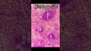 Histology of spleen  Histology slide of spleen  histology histologymbbs spleen draw mbbs [upl. by Anilyx638]