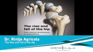 The Rise and Fall of the hip by Dr Ringte Agricola [upl. by Sim]