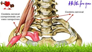 Saúde  Sintomas e tratamento da costela cervical [upl. by Hnid]