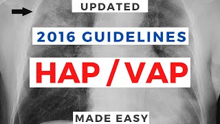 HospitalAcquired Pneumonia amp VentilatorAssociated Pneumonia  2016 Guidelines [upl. by Enrahs]