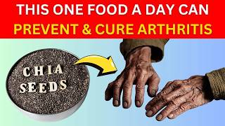 Top 8 BEST Foods to Prevent amp Cure Arthritis  Arthritis Pain Relief [upl. by Sina]