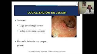 Lecture quotMucosectomía y disección endoscópica submucosa en el esófagoquot  Dr Claudio Navarrete [upl. by Lalaj]